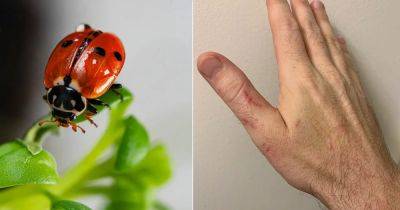 Do Ladybugs Bite | What Does a Ladybug Bite Look Like - balconygardenweb.com