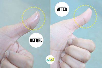 How to Remove Super Glue from Skin: 4 Methods that Work - fabhow.com - Poland