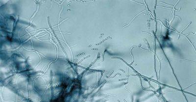 How to Use Streptomyces Lydicus to Battle Fungi and Plant Pathogens - gardenerspath.com - Britain